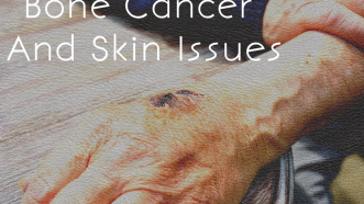 Bone Cancer: What It Can Do To Your Skin